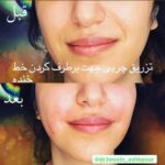 کلینیک زیبایی دکتر اشک پور در بوشهر
