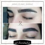 کلینیک زیبایی ارس در شیراز